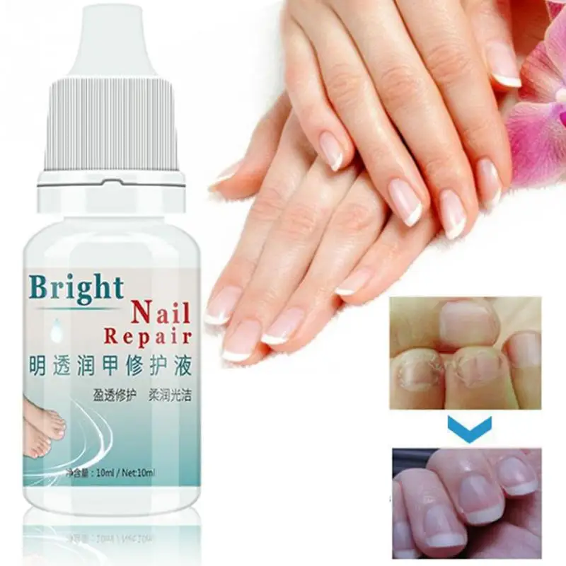 Nail Problem Treatment Of Onychomycosis Repair Two Bottles Bacteriostat one bottle repair | Красота и здоровье
