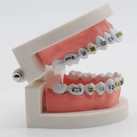dentist study orthodontic model ortho metal bracket arch wire ligature tie for dental supplies