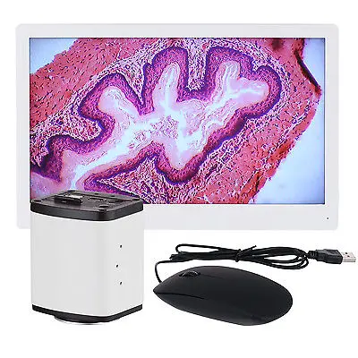 

AmScope HD1080A-HDM 1080p HDMI Microscope C-mount Camera + HD Monitor