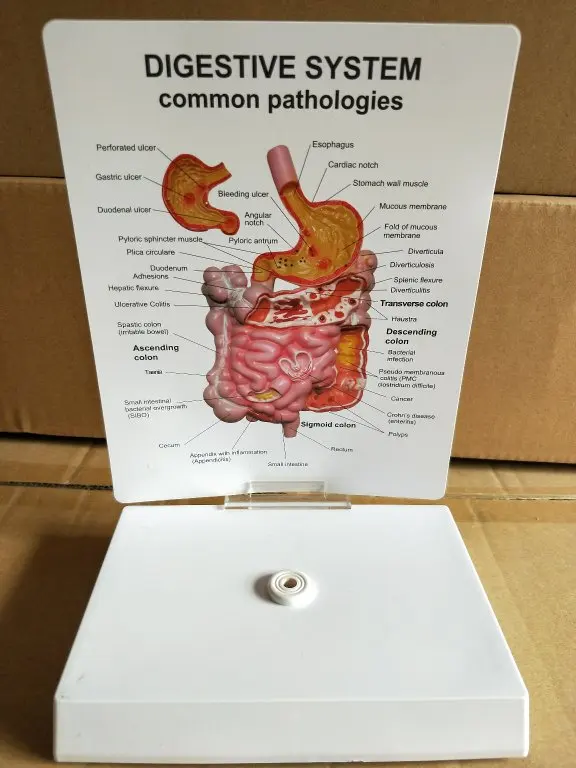 Модель желудочно кишечной патологии человека демонстрационная модель общения с