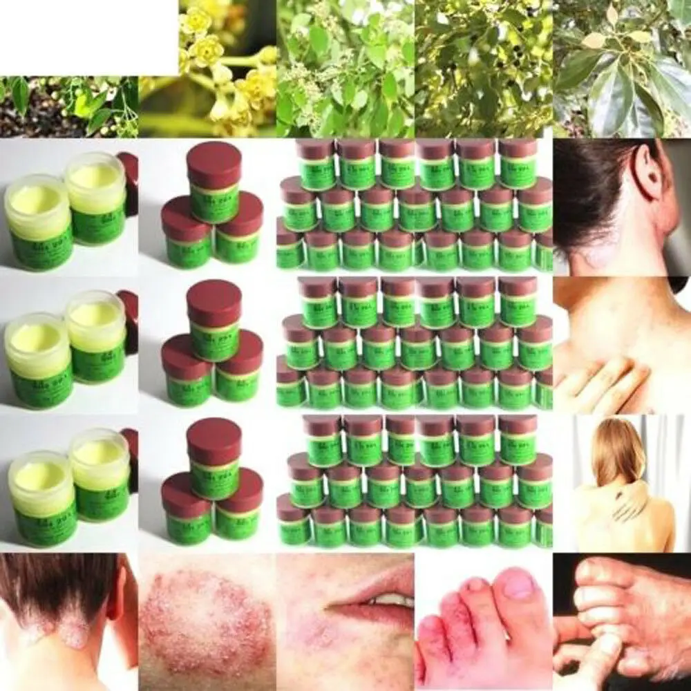 Натуральный Крем Масло мазь для лечения псориаза рингчервь крем Tinea Eczema Psoriasi Eczma уход за кожей лечение всех типов кожи TSLM1