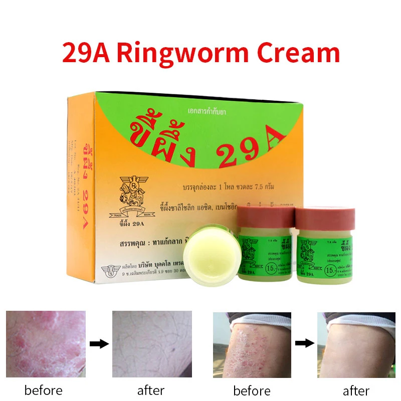 

Psoriasis Eczma Cream Works Perfect For All Kinds Of Skin Problems Patch Body Massage Ointment 1pc