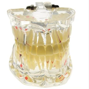 Промоакция, зуб для стоматологического Кабинета, прозрачная модель патологических зубов для взрослых, стоматологическое лабораторное оборудование, обучение стоматологиям