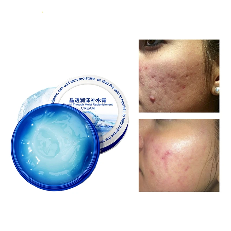 

Дневные солнцезащитные кремы, увлажняющая свежая, прохладная маска-желе, для подтяжки лица, увлажняющий, против морщин коллагеновые клетки,...