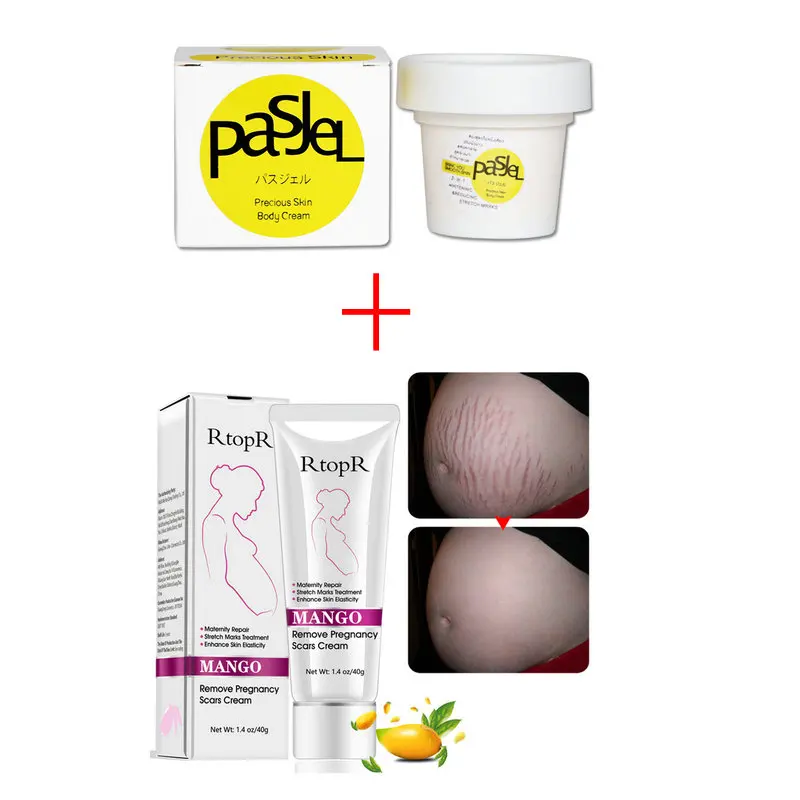 

Pasjel And Rtopr Stretch Marks Remover Thailand Maternity Precious Skin Body Cream Effectively Pregnancy Scars Removal Creme