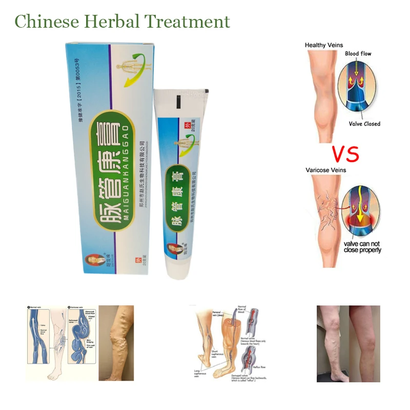 10 упак. Варикоз медицинский препарат против варикозного расшрения вен крем для