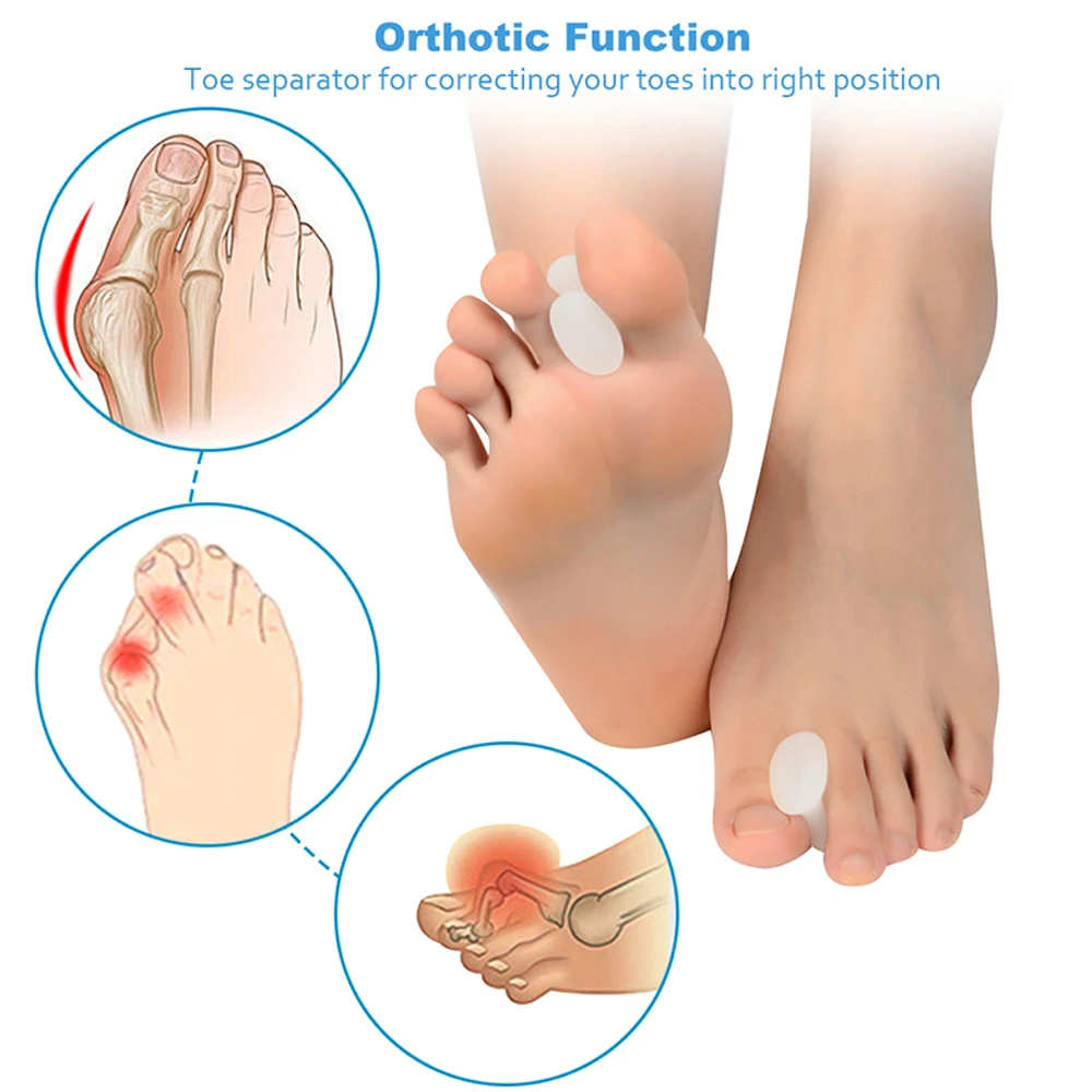 Силиконовый гелевый сепаратор пальцев для коррекции вальгусной деформации