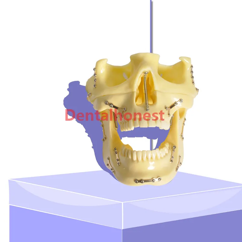 high quality Dental model 2016  Anchor Implant Screw Practice Model