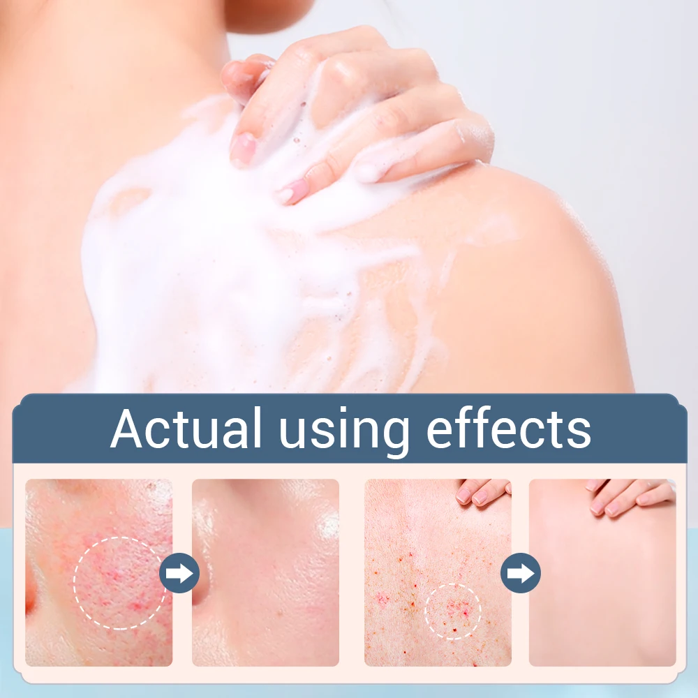 чистка лица пенка для умывания Крем макияжа soonpure Анти пыль антиклещевое Мыло