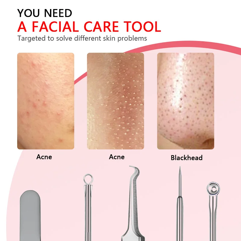 3 шт. нержавеющая сталь Угри лица акне пятнистый прыщей экстрактор удаления иглы