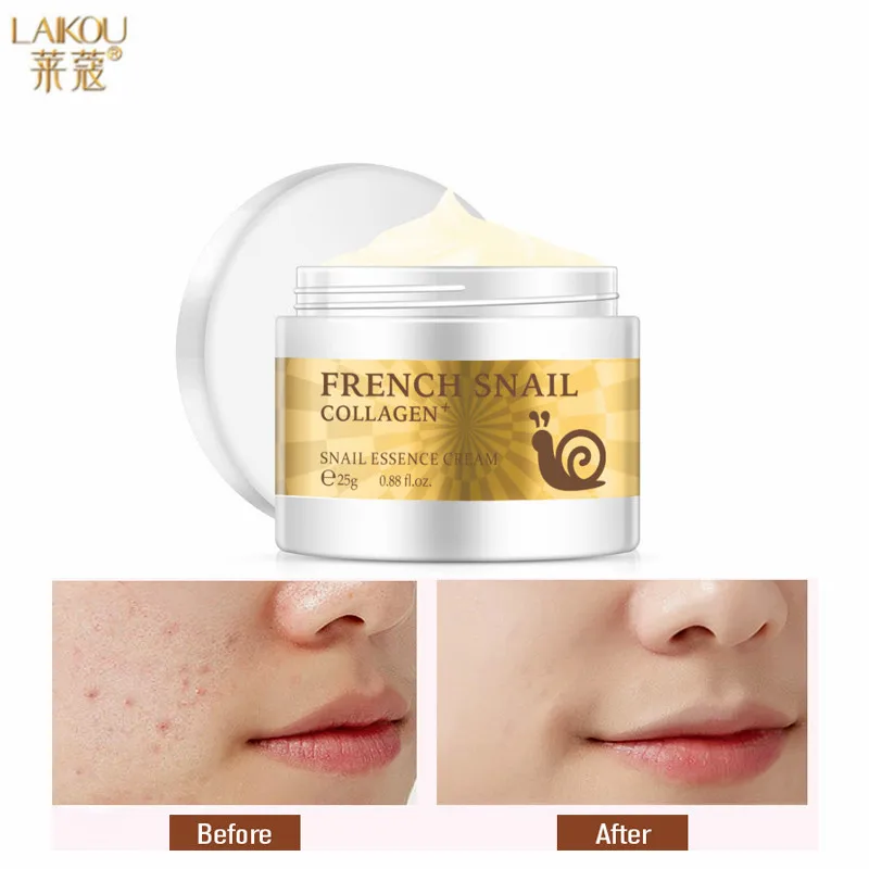 

LAIKOU 25g Snail Collagen Essence Nourish Cream Whitening Moisture Shrink Pores Anti-Wrinkle Anti Aging Professional Skin Care