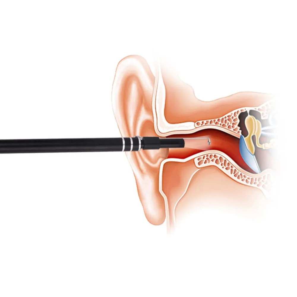 Wifi HD hand-hold Multifunctional Endoscope &amp Visual Earpick USB Ear Cleaning Earwax Removal Drop Shipping | Красота и здоровье