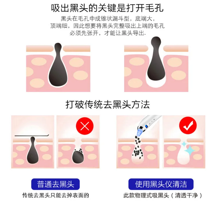PRETTY SEE Electric Blackhead Remover Powerful Vacuum Suction Machine Cleanser Device with 4 Replaceable Heads | Красота и здоровье