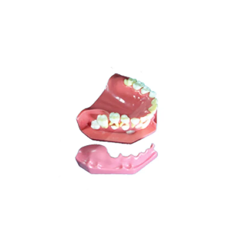 Dental Oral Study Teaching Teeth Model Removable Gum to Show Children's Tooth of 3-6 Years Old