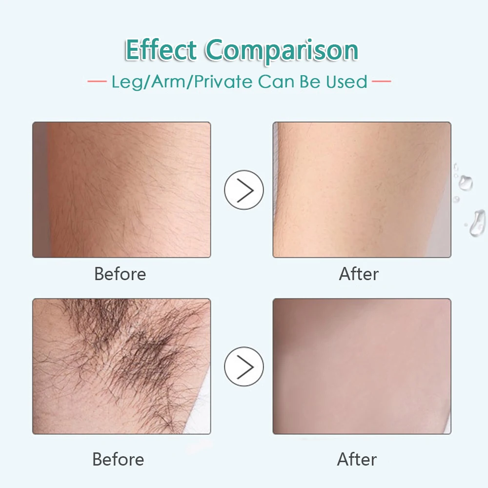 Permanent Hair Growth Inhibitor After Unhairing Repair Essence Shrinking Pores Depilated Skin Care Essence 10ml TSLM2