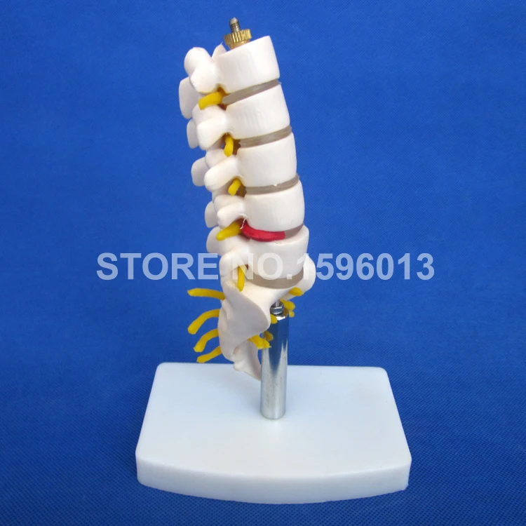 Мини поясничная модель позвонка с крестиком коциксом и грыжевым диском поясным