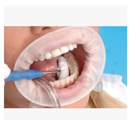 50 шт. Ретрактор для щек из натурального каучука|cheek retractor|rubber damgum dam |