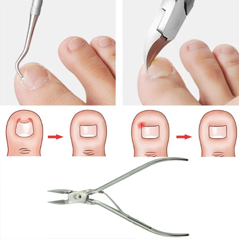 1 шт. инструменты для коррекции ногтей удаления мертвой кожи педикюра JAN10|Ножницы