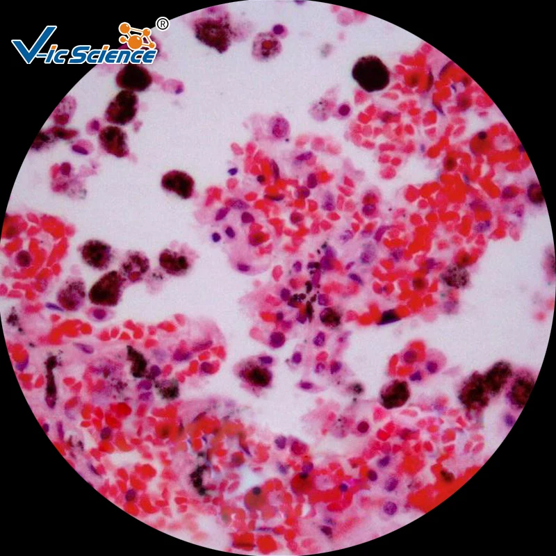 Медицинские науки 100 шт патологии человека Горки Набор|pathology slides|set 10set medic |