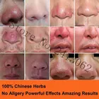 Жемчужный крем от акне красная мазь для носа крем для удаления черных точек угрей уход за кожей травяной против акне клещей розовые угри для лечения сужения пор