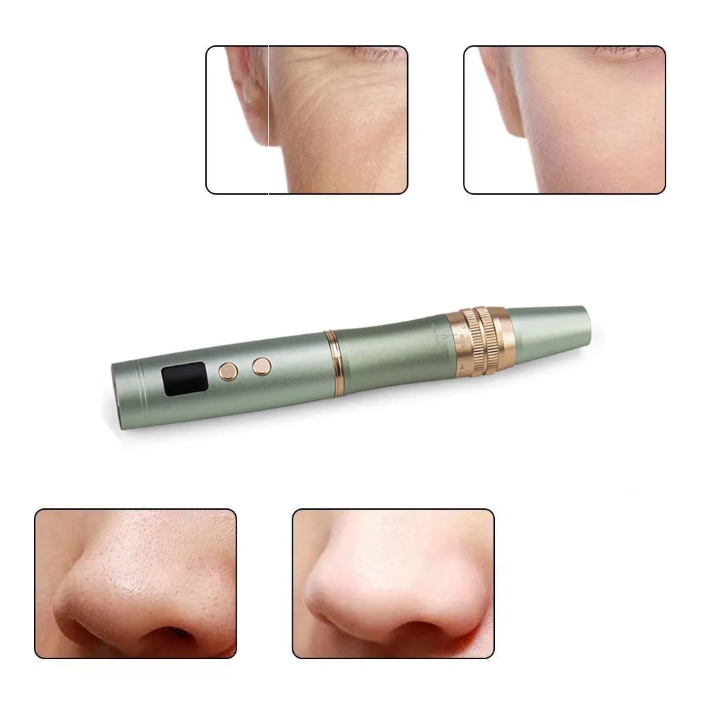 Беспроводная фотонная терапия Dr Pen 4 цвета Ultima Dermapen голубая светильник ная микро