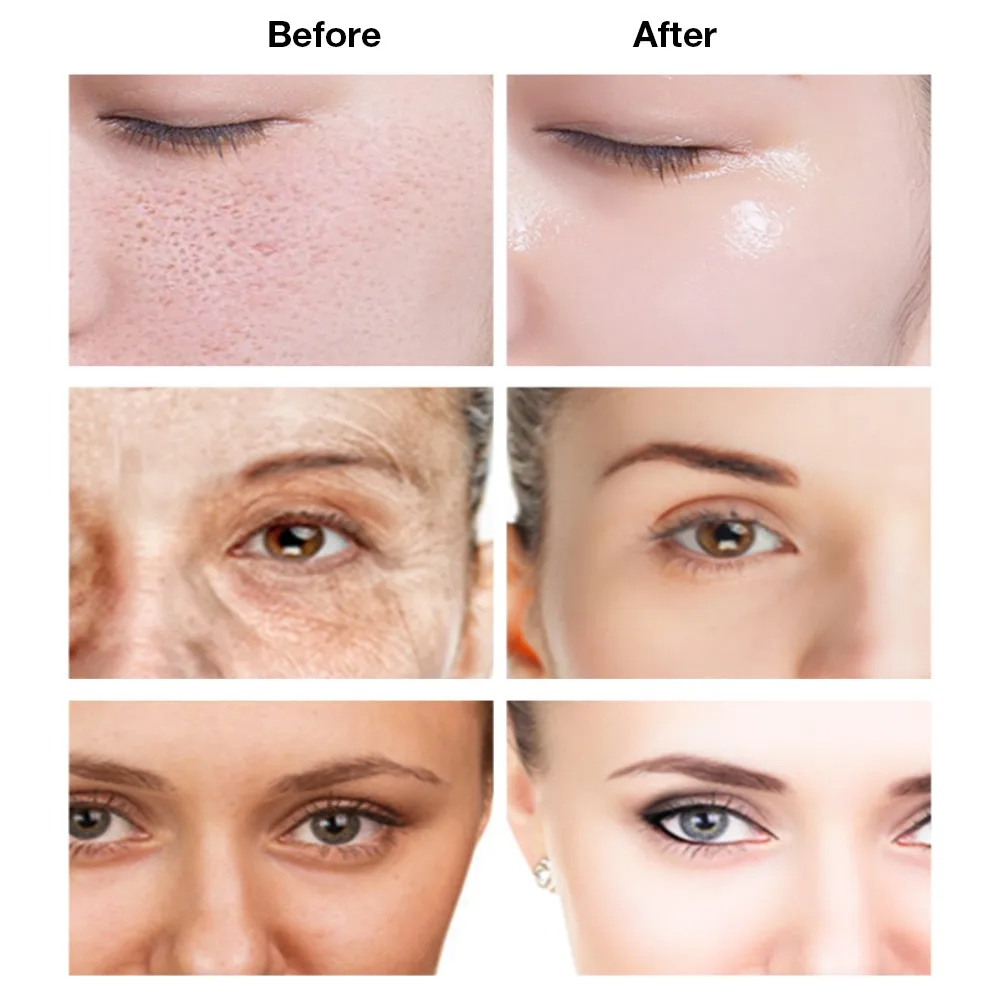 

2pcs 15ml old Hyaluronic Acid Face Serum Replenishment Moisturize Shrink Pore Brighten Nicotinamide Skin Care Lift Firming Ess