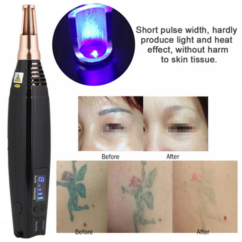 

Professionele Laser Picosecond Pen Sproet Tattoo Removal Gericht Doel Lokaliseren Positie Mol Spot Wenkbrauw Pigment Remover Acn