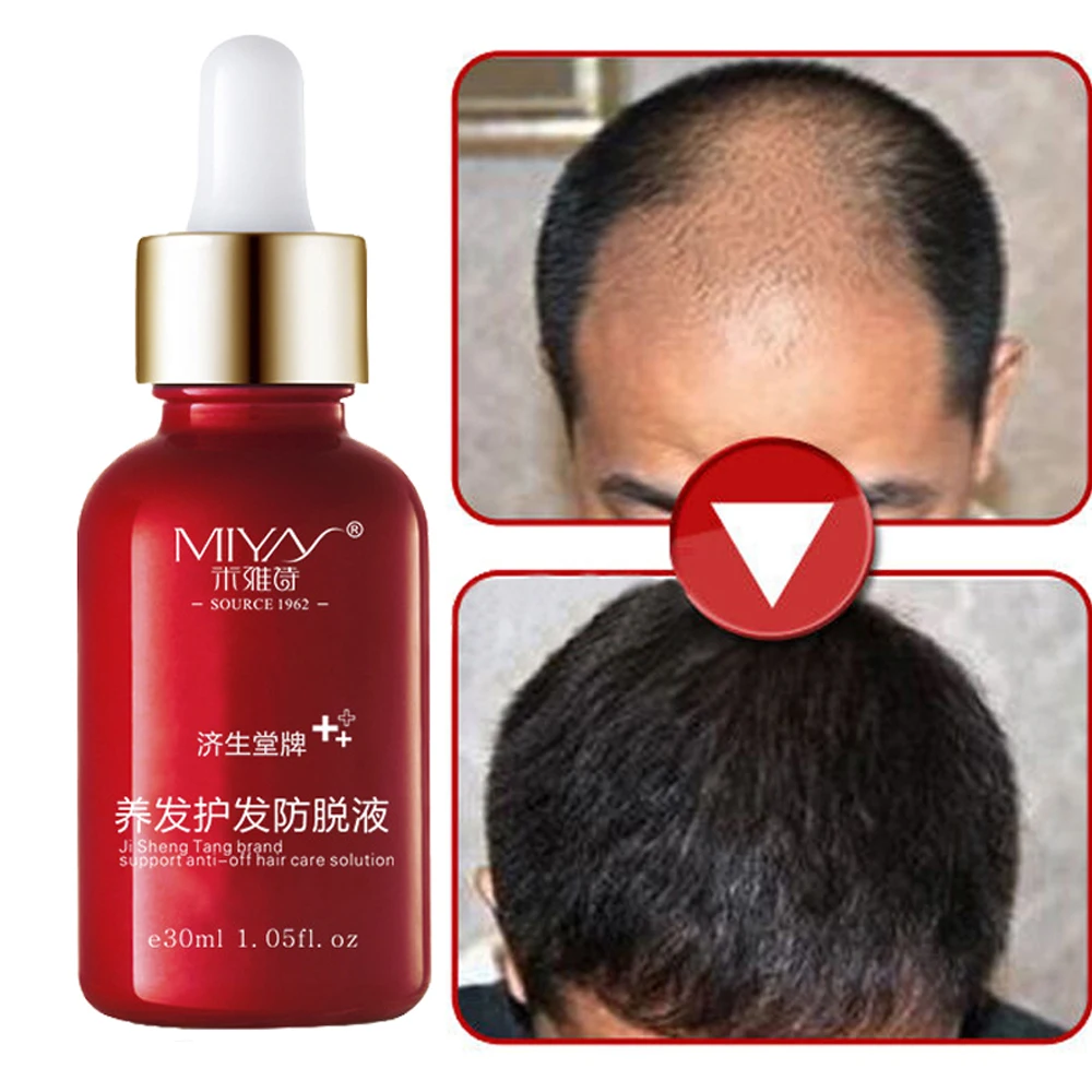 Масло для волос уход за волосами быстрое мощное средство роста эссенция жидкость