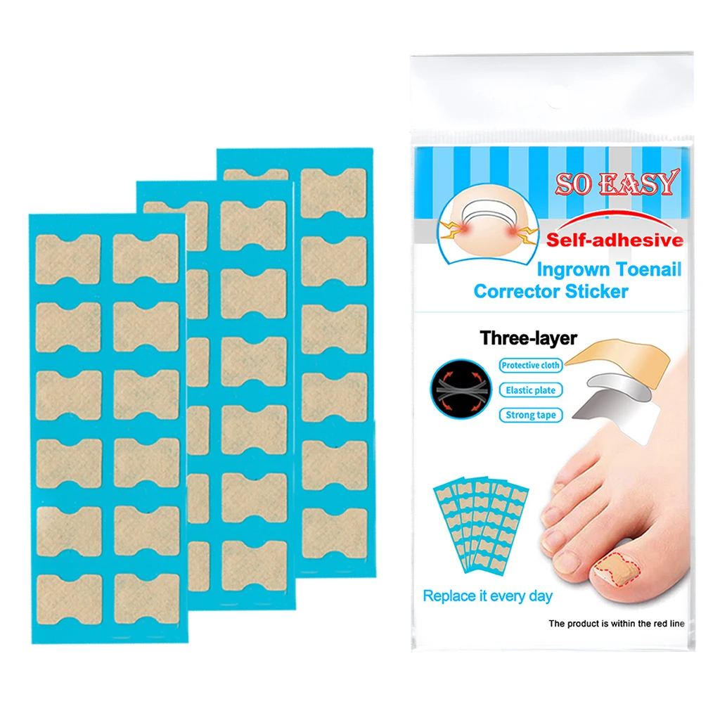 

Ingrown Toenail Corrector Sticker Toe Nail Treatment Repair Orthosis Correction
