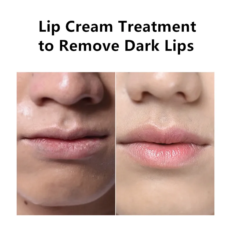 

Pink Fresh Lightening Lip Cream Treatment to Remove Dark Lips Lip Balm Moisturizes And Prevents Dry Cracking