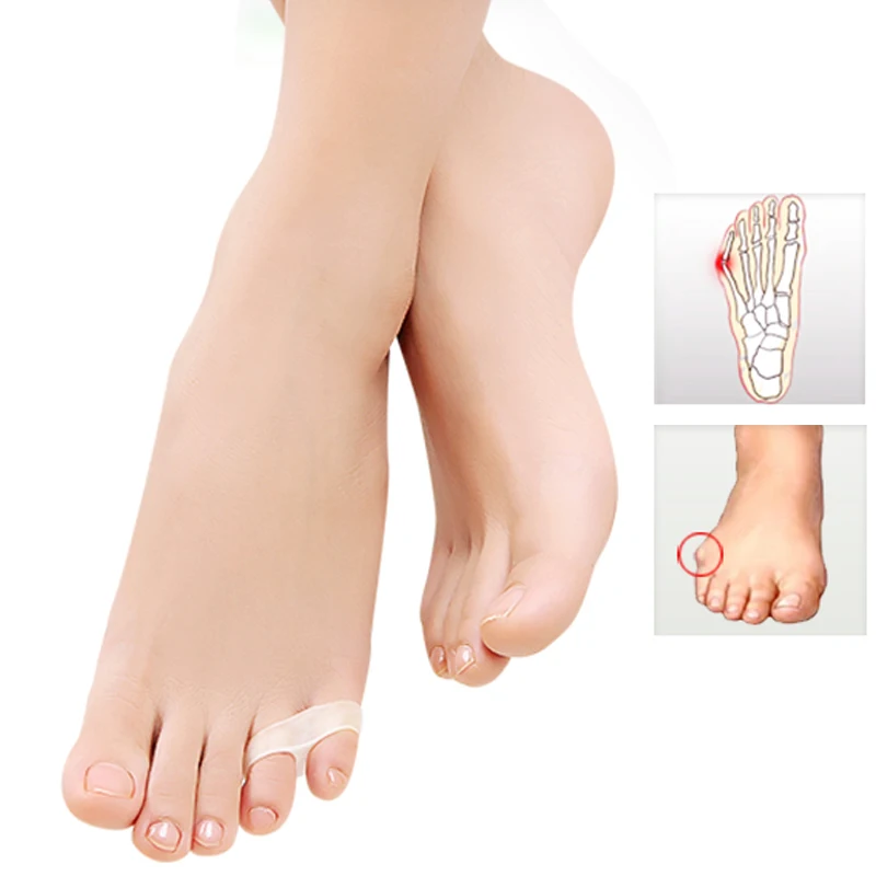

1-10 Pair Hallux Valgus Soft Gel Little Toe Separators Orthopedic Overlapping Corrector Sport Straightener Feet CarePedicure