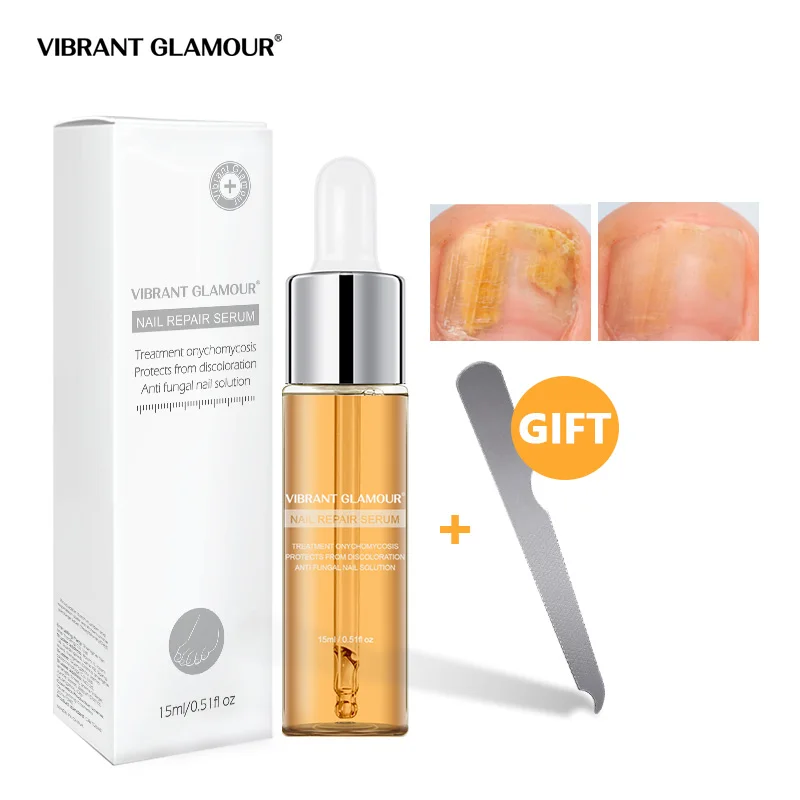 

VIBRANTGLAMOUR Fungal Nail Treatment Feet Care Serum Nail Foot Nail Fungus Removal Gel Anti Infection Paronychia Onychomycosis