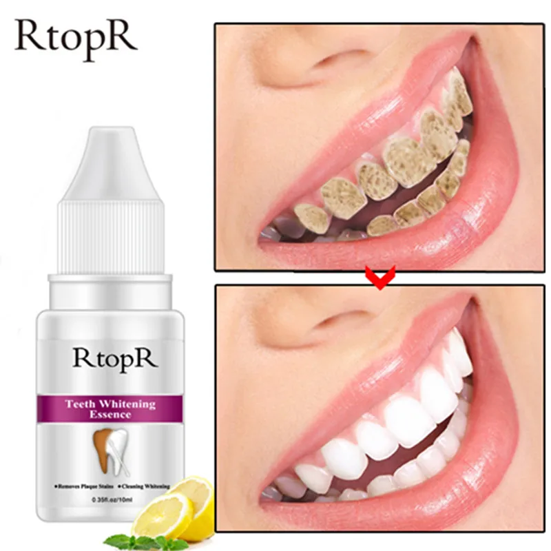 10 мл отбеливание зубов эссенция удаляет пятна зубного налета стоматологические