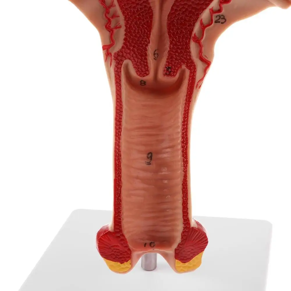 1:1 человеческая Женская матка ячейка Fallopian Tube модель анатомические человеческие
