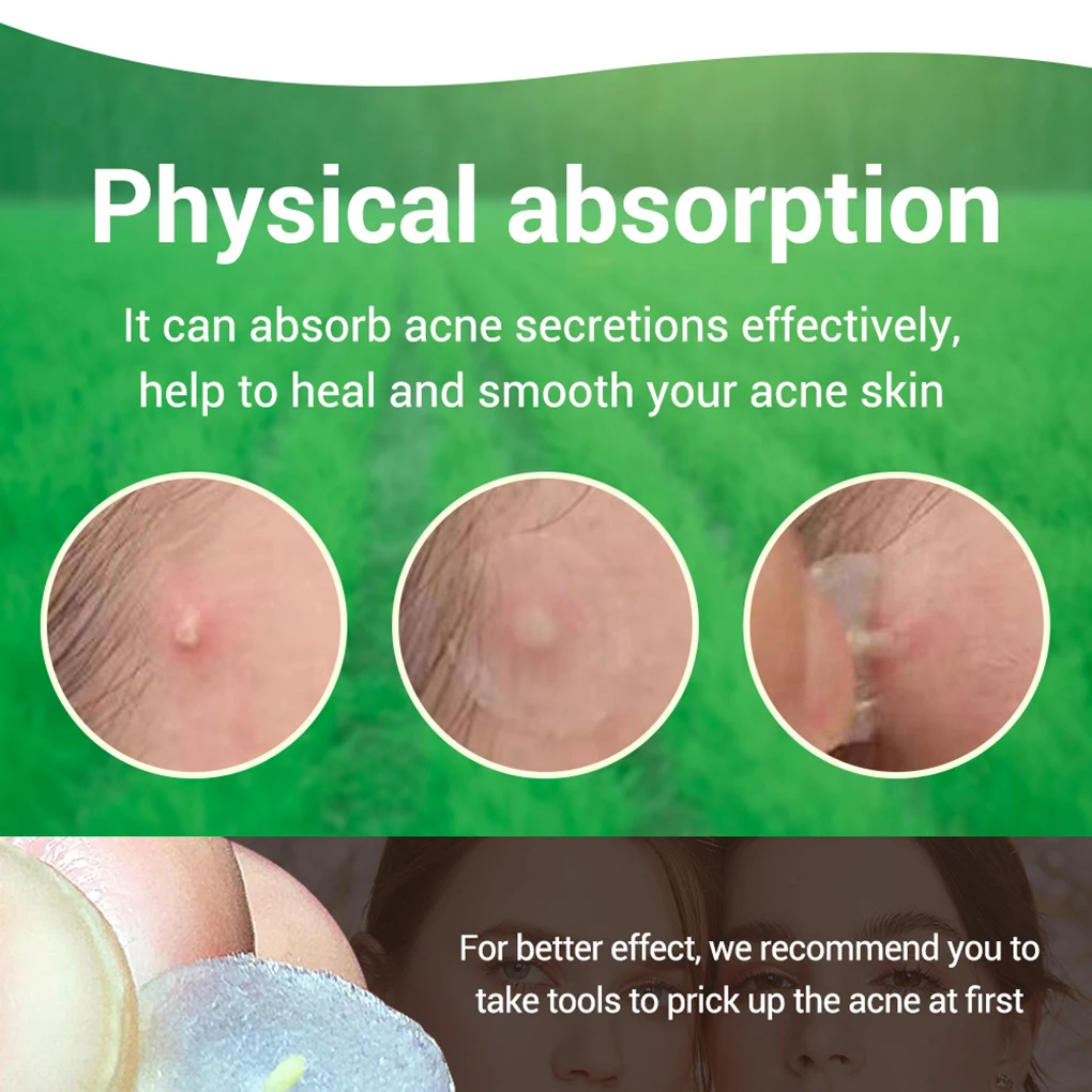 BREYLEE Acne Pimple Patch Treatment Stickers Remover Tool Blemish Spot Skin Care Face Mask Cream Daily Use | Красота и здоровье