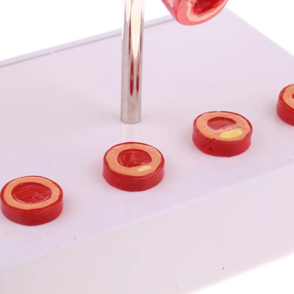 Лабораторные принадлежности 50 раз увеличенный человеческий сосуд атеросклероза