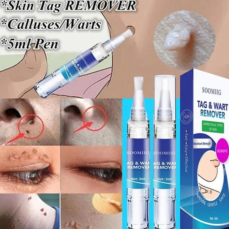 

3ml Wart Removal With 36 Stickers Wart Removal Patches Wart Moles Set Against Care Combination Removal Skin D7S5