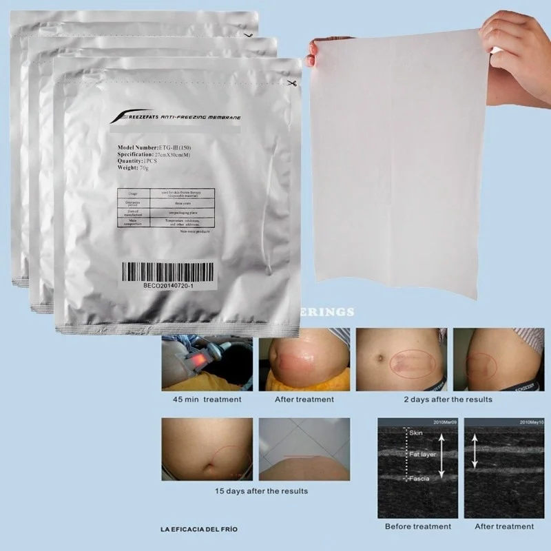 

Cryo Pad Cryolipolysis, противофризовая Мембрана для защиты кожи, размер 34 х42 см, 28 х28 см, 27 х30 см