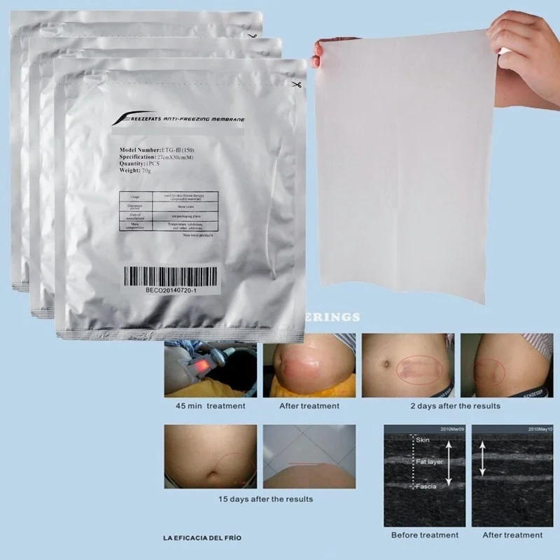 

Wholesale Cooling Shape Antifreeze Membrane For Anti Freezing Membranes For Fat Freezing Item No. 184150856