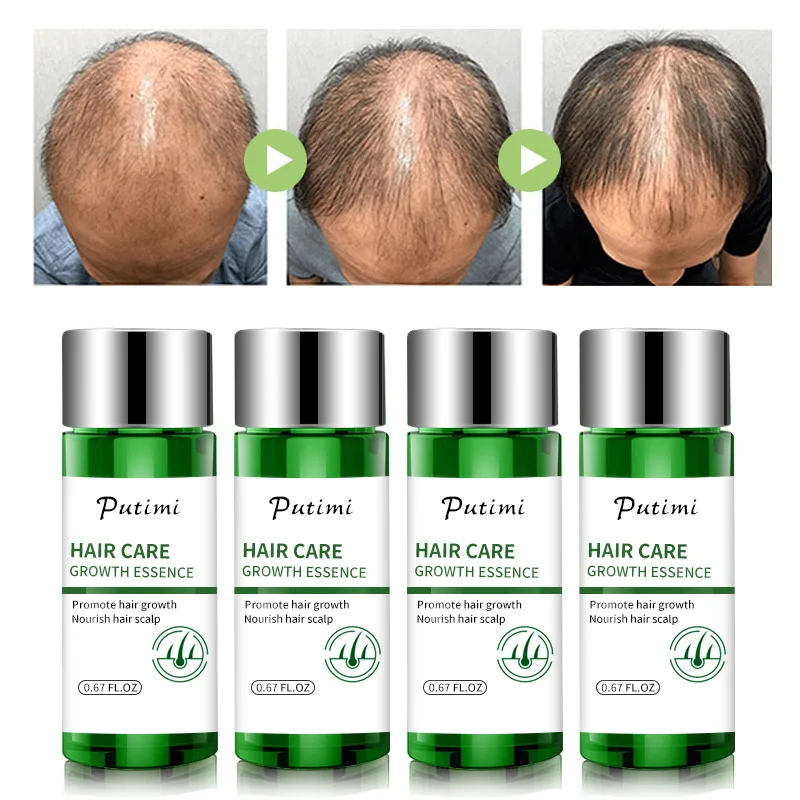 Putimi мощная Сыворотка для роста волос продукты против выпадения сыворотка более