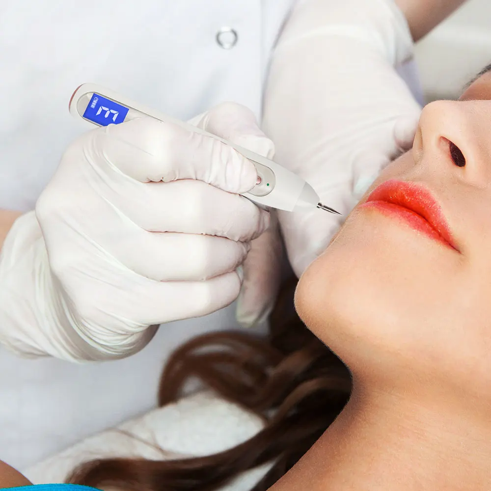 

Professional Moles Removal Pen Xpreen LCD Display Laser Plasma Pen Warts Remover Spot Tattoo Cleaner Skin Tag Removing Machine