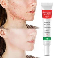 15g treat acne scars remove blackheads shrink pores oil repair care cosmetics skin control korean gel whitening cream