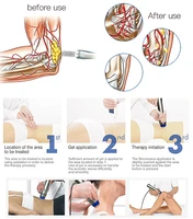 Hand Piece With Digital Smartwave Eswt Low Intensity Shockwave Therapy For And Physicaly For Body Pain Relif