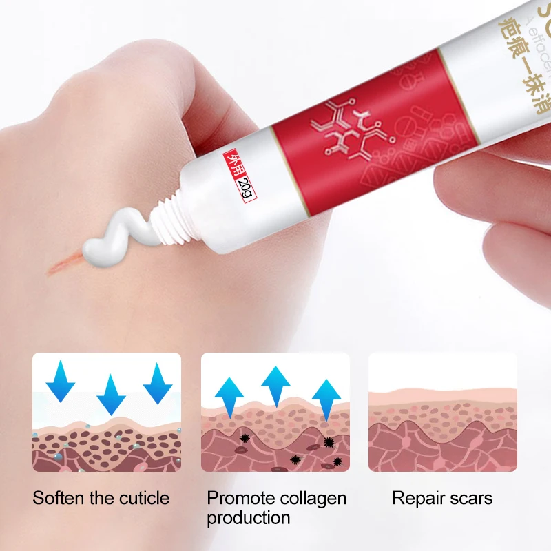 

Skin Care 1Pcs Skin Repair Scar Removal Ointment Tattoo eyebrow face Repair Cream Body Ointment P1158