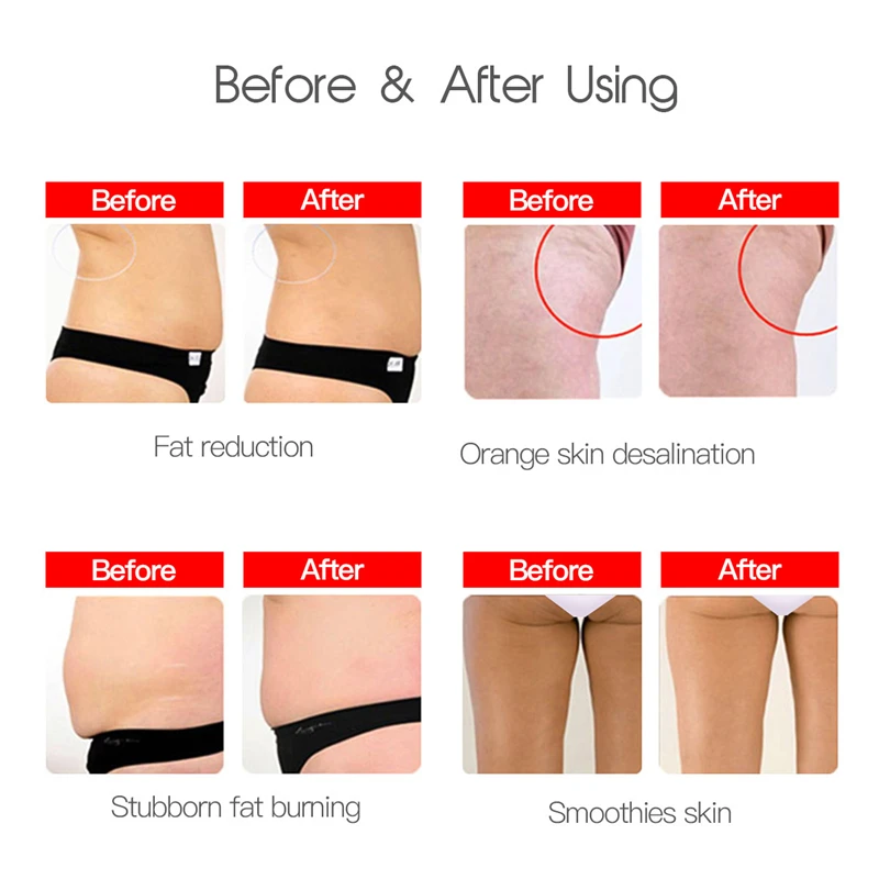 Электрический массажер для тела 3 в 1 RF массаж похудения омоложения кожи потери