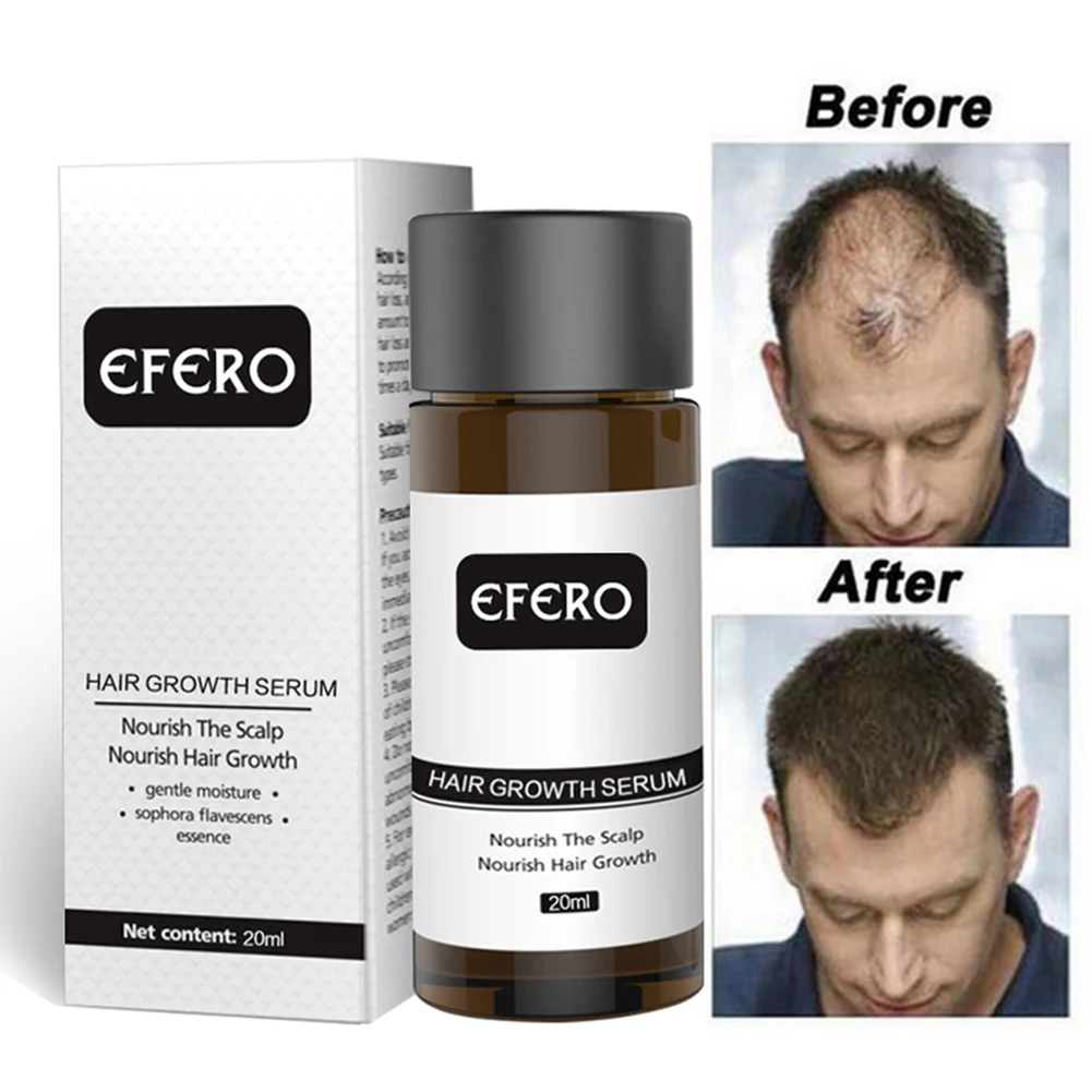 

20ml Hair Growth Serum Promote Hair Regrowth Essence Prevent Baldness Hair Loss Growth Essential Oil for Men Women Shipping