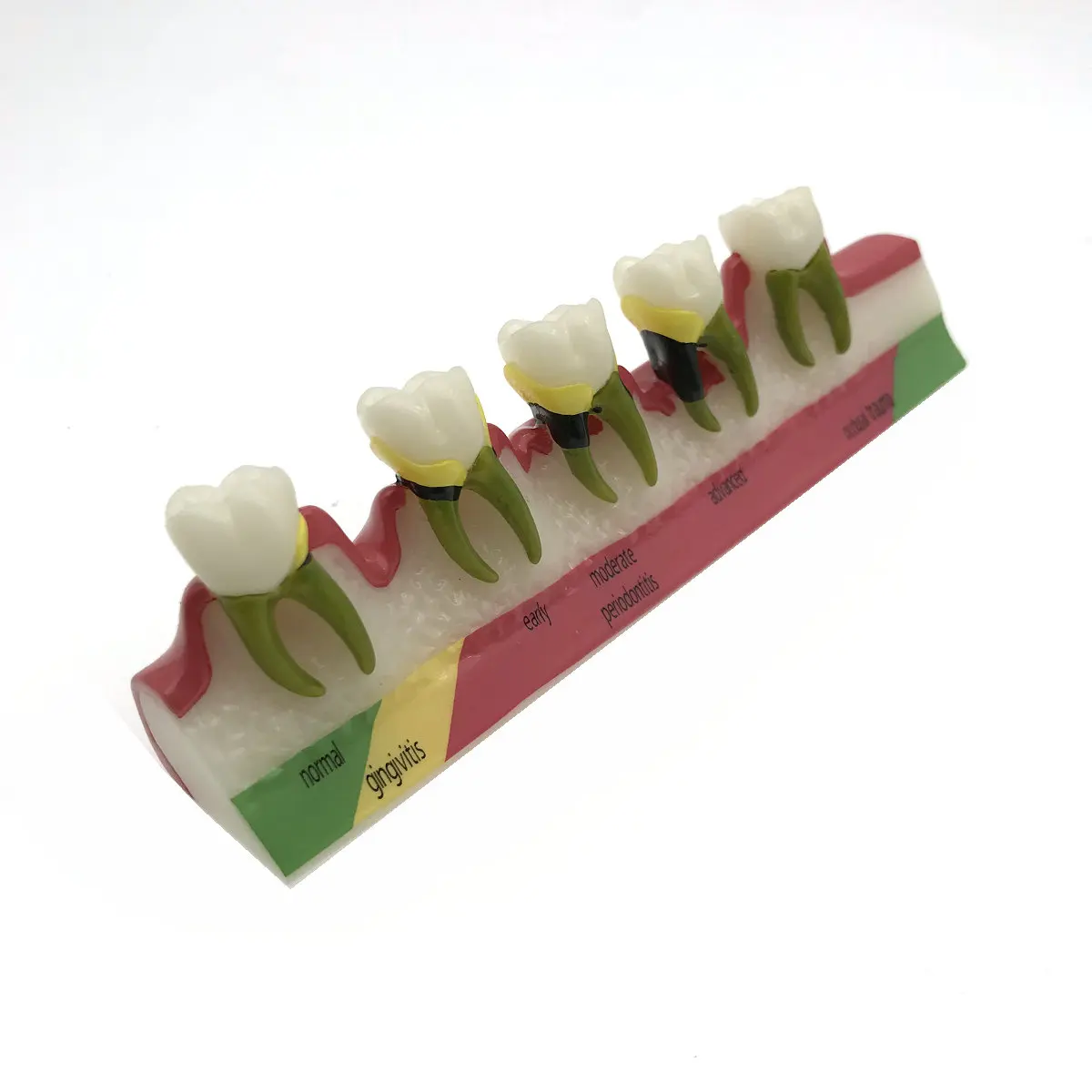 Стоматологический периодонтальный болезни разбирают зуб Typodont модель|model craft|model