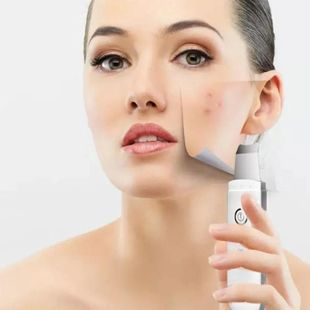 

Clean Skin Tool Cleaner Ion Acne Blackhead Remover Deep Cleaner Massager Face Lift Machine Vacuum Suction