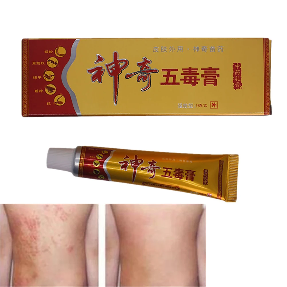 Волшебная ядовитая паста китайский профессиональный медицинский крем