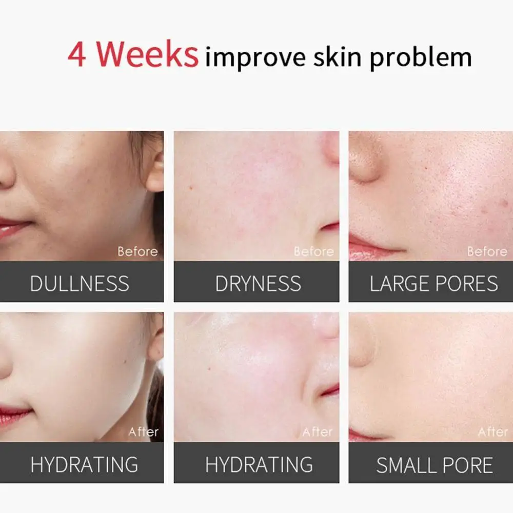 

Water Oil Separation Essence Moisturizing Oil Control Antioxidant Moisturizing Cocktail Milk Oil Maintaining Essen Water Ba L4H2